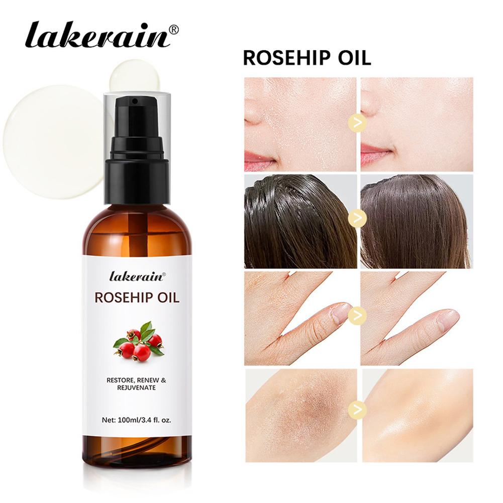 Rosehip Oil For Face & Skin Or - огляд і ціна Cold Pressed Rose Hip
