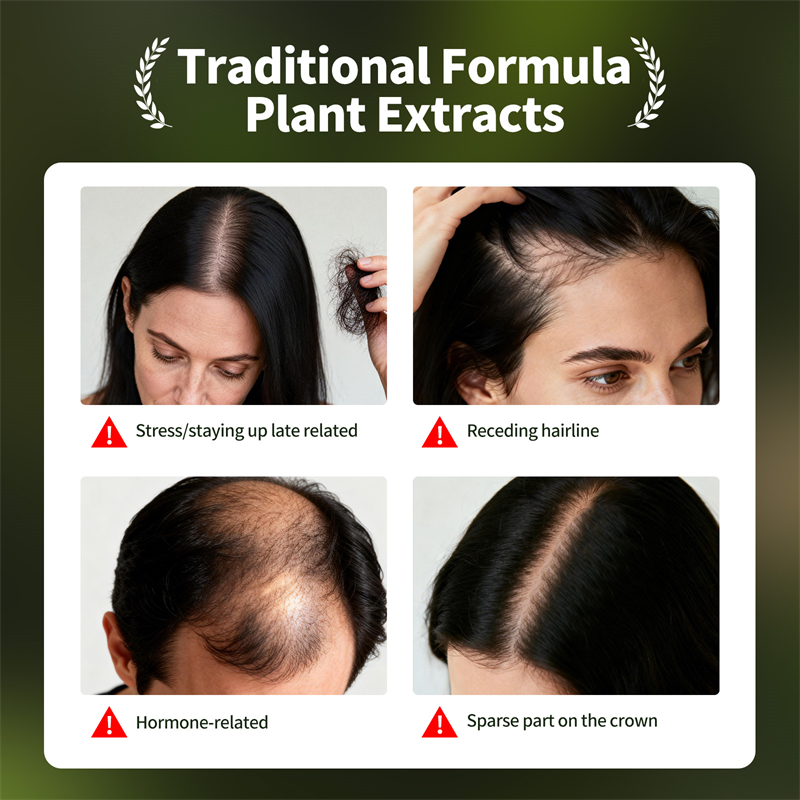 Natural Hair Growth Set Usman  - огляд і ціна Epidermal Growth Factor