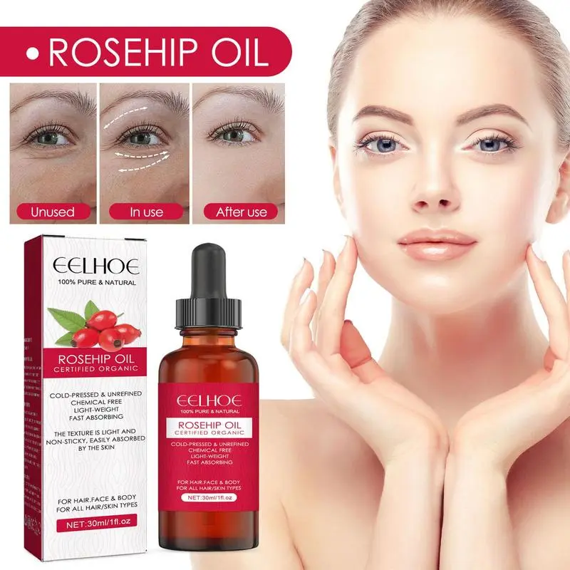30ml Organic Rosehip Seed Oil  - огляд і ціна Cold Pressed Rose Hip