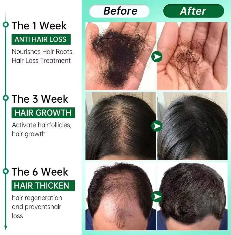Hair Growth Serum 7 Days Fast  - огляд і ціна Epidermal Growth Factor