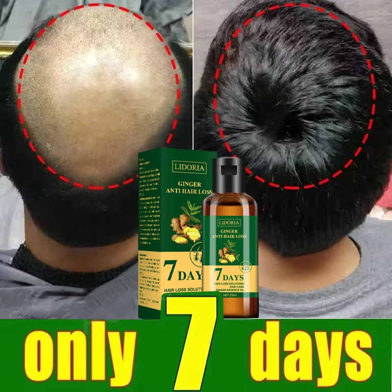 Hair Growth Serum 7 Days Fast  - огляд і ціна Epidermal Growth Factor