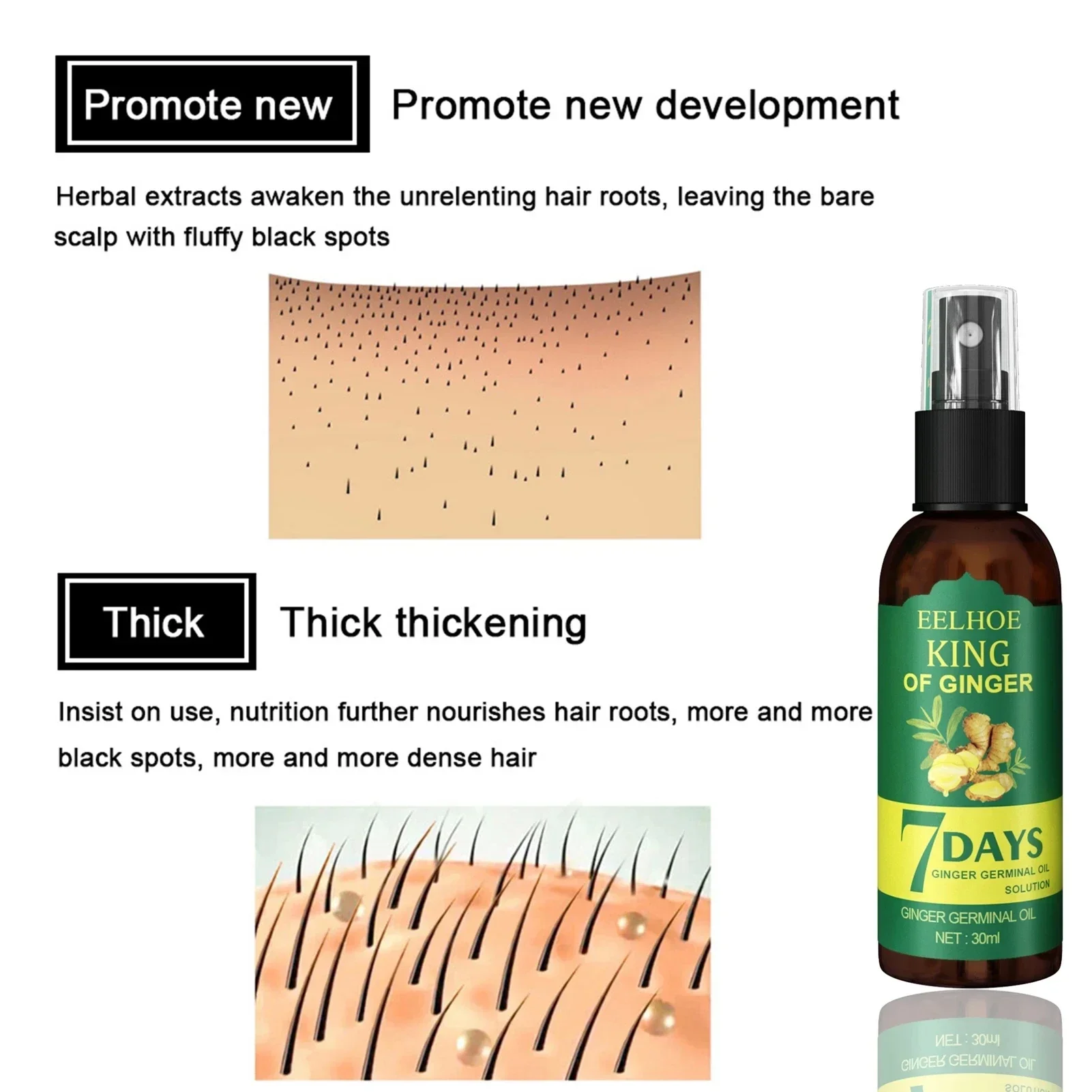 2024 Ginger Hair Growth Serum  - огляд і ціна Epidermal Growth Factor